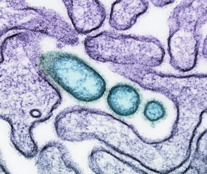 Photo by National Institute of Allergy and Infectious Diseases a close up of an animal cell with blue cells
